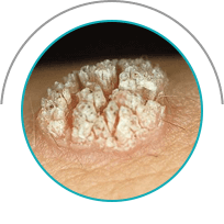 Milozol